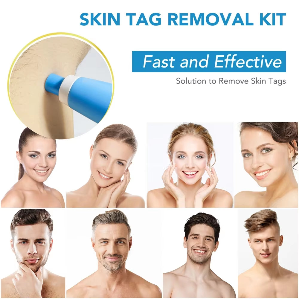 2 in 1 Auto Micro Skin Tag Remover Device Standard and Micro Skin Tag Removal Kit Adult Mole Wart Remover Face Care Beauty Tools