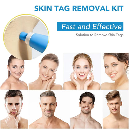 2 in 1 Auto Micro Skin Tag Remover Device Standard and Micro Skin Tag Removal Kit Adult Mole Wart Remover Face Care Beauty Tools