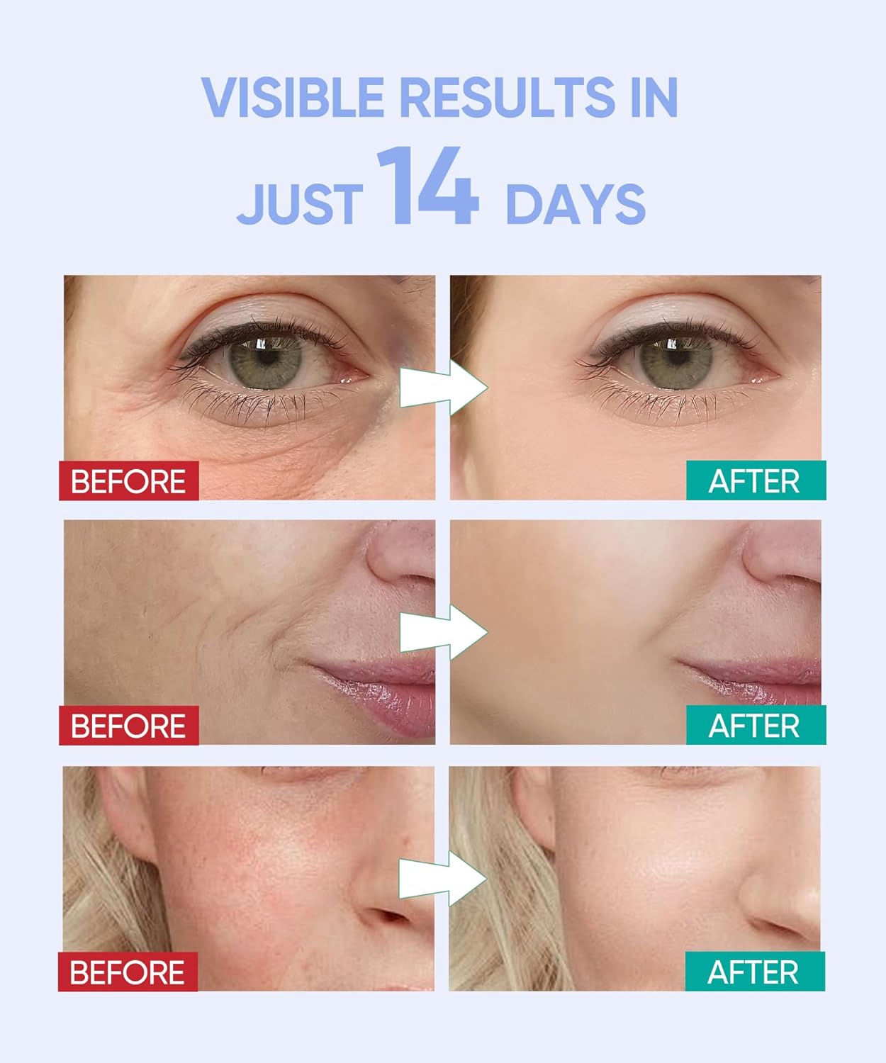 Led Face Mask Light Therapy, Red Light Therapy for Face, 7-1 Colors LED Facial Skin Care Mask, Black